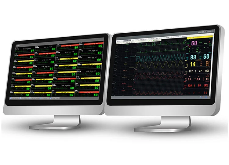 Moniteur MFM-CNS
