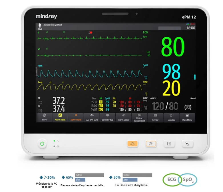 Moniteur Patient Série VS